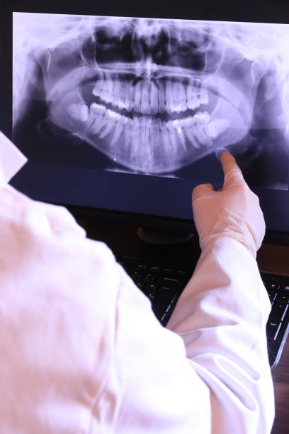 Best Emergency Tooth Extraction in Trappe, MD