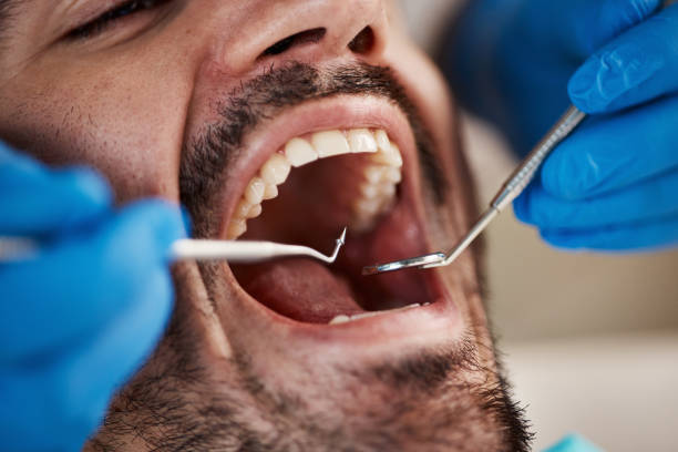 Best Emergency Denture Repair in Trappe, MD